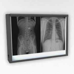 X-Ray Viewers